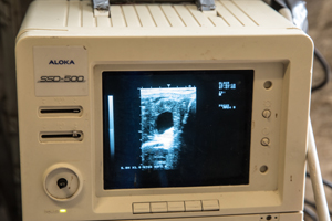 Ultraschall Ultraschall
